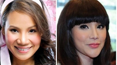 Hoảng hốt nhan sắc biến dạng của sao Việt vì 