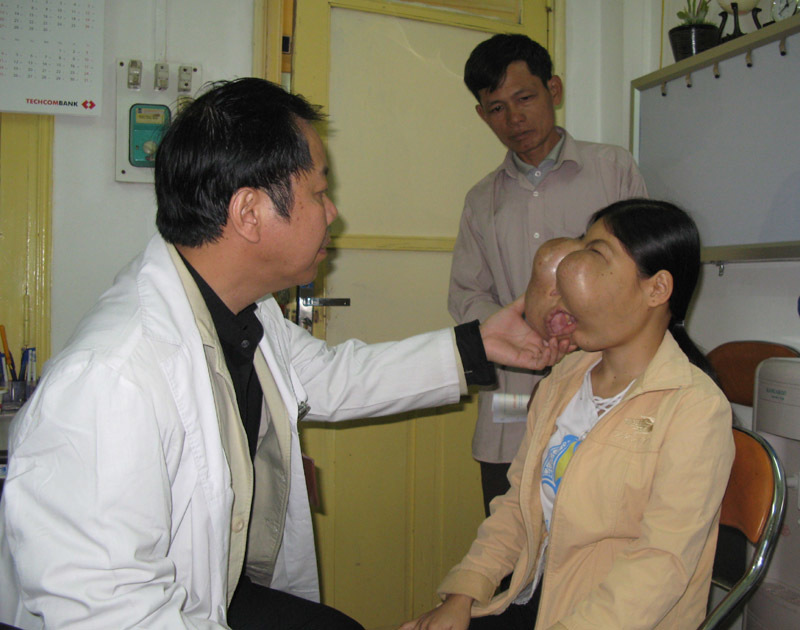 BS Nguyễn Quốc Bảo: Khắc tinh của những khối u quái