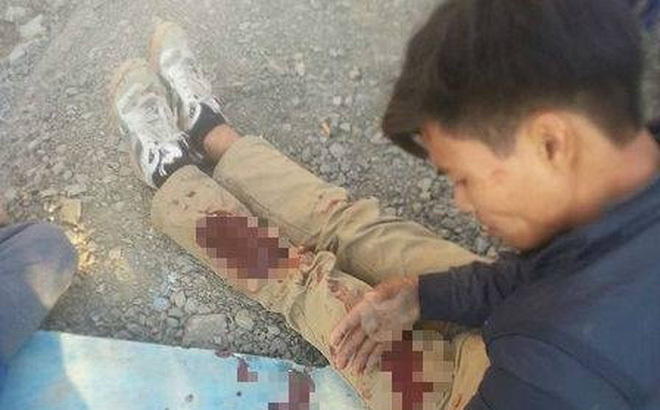 Hà Nội: Quay clip cãi nhau, nam thanh niên bị chém trọng thương