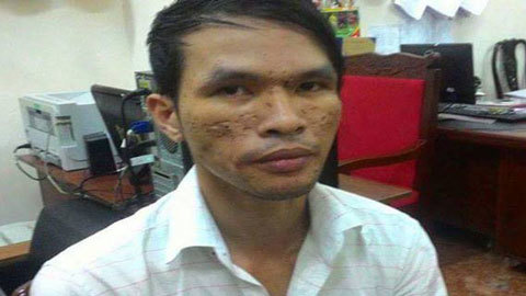 Lời khai của nghi can bạo hành trẻ em gây rúng động