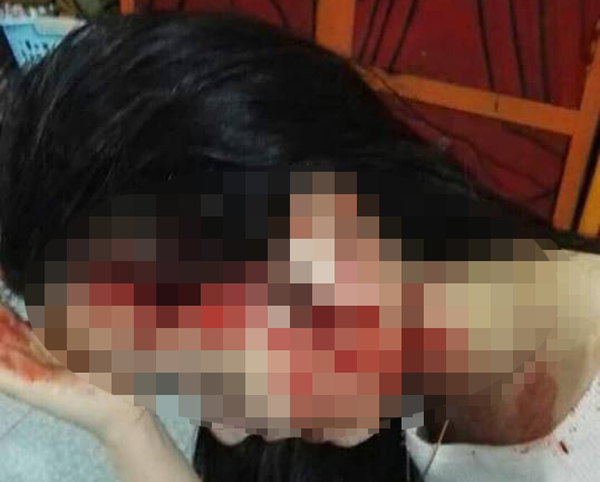 Bắt cóc cô gái lên taxi, dùng dao đâm nhiều nhát