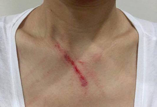Một phụ nữ bị đánh trong thang máy ở Linh Đàm