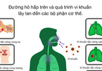 Các biến chứng nguy hiểm của viêm họng