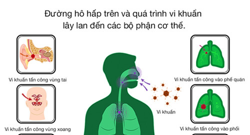 Các biến chứng nguy hiểm của viêm họng