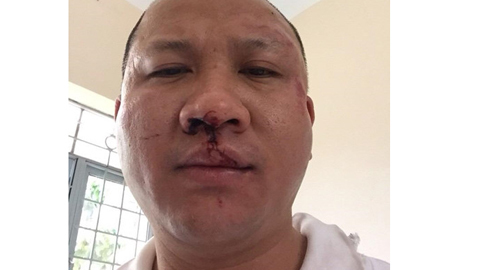 1 phụ nữ bị truy tố vì cướp của đại gia gần 1 tỉ đồng