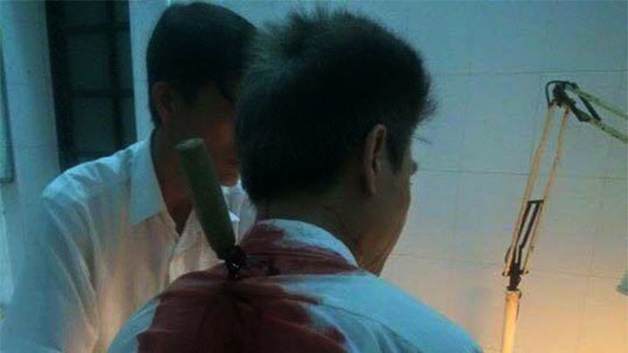 Người chạy xe ôm bị đâm xuyên vai khi bắt cướp ở Sài Gòn