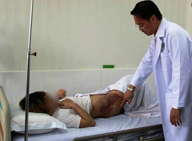 Cô gái bị gãy khung chậu, rách âm đạo do tai nạn