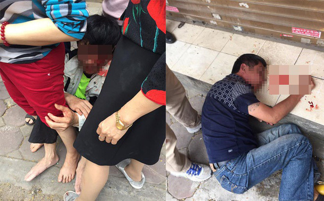 Hà Nội: 3 người bị đánh toét đầu vì nhầm trộm xe SH