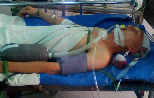 Tai nạn khó tin khi nằm võng ngày mùng 3 Tết