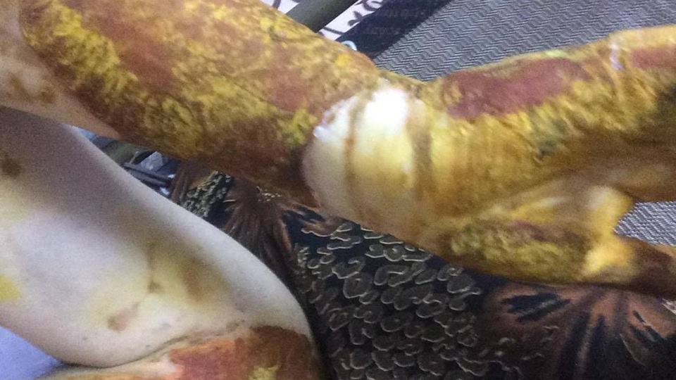 Nữ sinh bị bỏng nặng: 4 bạn học công khai xin lỗi