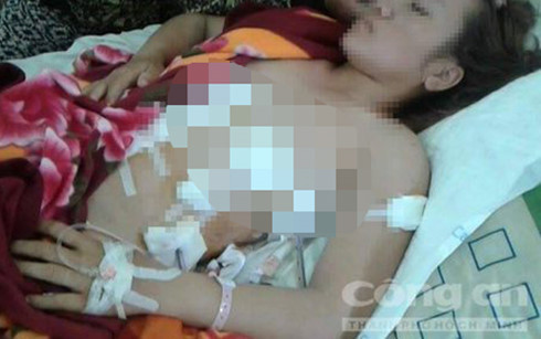 Người vợ trẻ bị nhân tình của chồng đâm 7 nhát dao