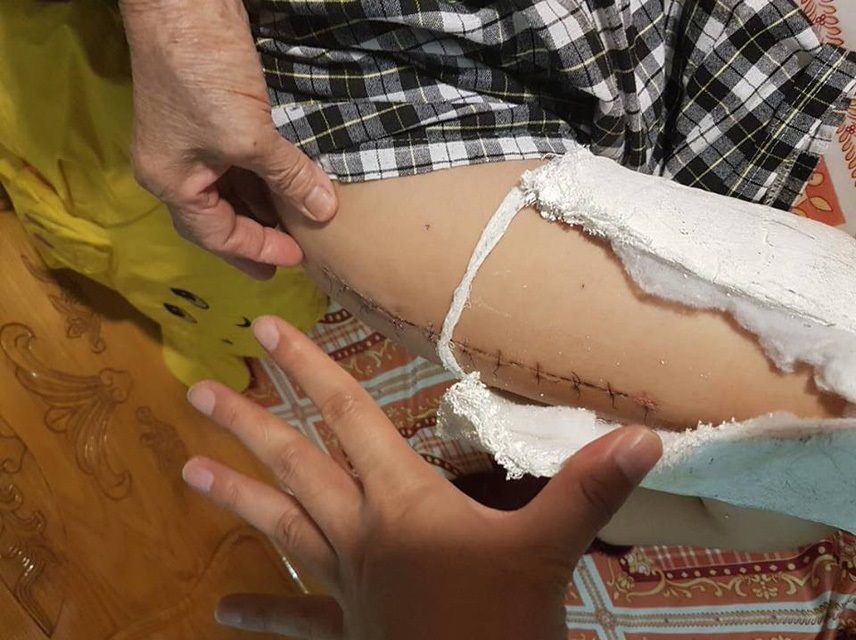 Vụ học sinh Nam Trung Yên gãy chân: 18 giáo viên phản bác ban giám hiệu