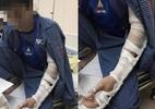 Hà Nội: 'Tranh địa bàn' làm thông bể phốt bị đánh nhập viện