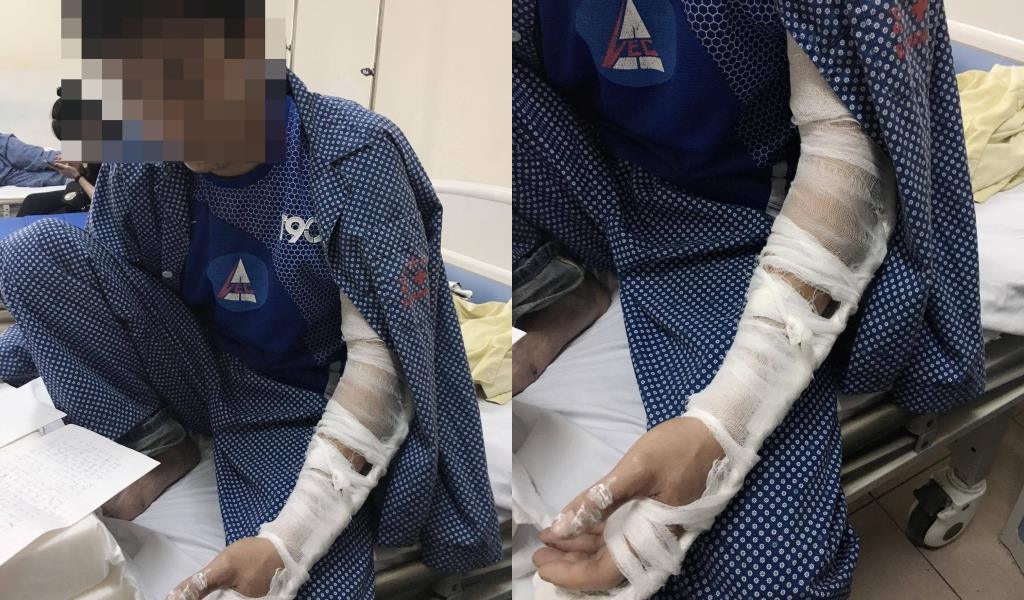 Hà Nội: 'Tranh địa bàn' làm thông bể phốt bị đánh nhập viện