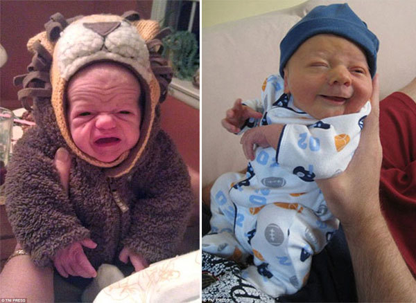 Những em bé mang khuôn mặt già nua khó tin