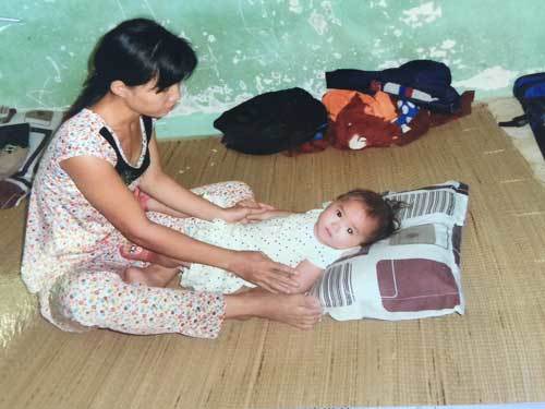 Thương bé gái 19 tháng tuổi ung thư sắp hỏng một bên mắt