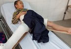 Vụ tai nạn Nam Trung Yên: Học sinh bị thương tật 32%