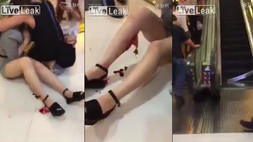 Cô gái bị thang cuốn trung tâm thương mại xé toạc chân