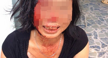 Con trai người phụ nữ bị chồng bạo hành: “Mẹ bị cha dượng đánh suốt 23 năm nay