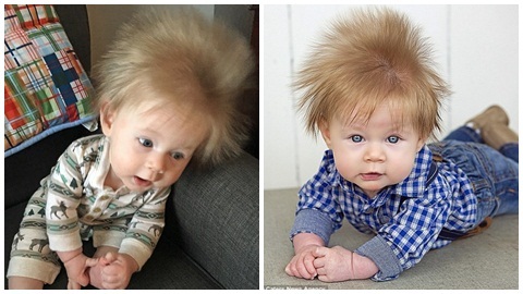 Cậu bé 5 tháng tuổi sở hữu mái tóc ‘điện giật’ bẩm sinh