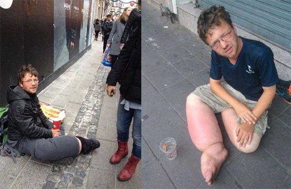 Lật tẩy mánh gạt tiền của gã ăn mày khét tiếng thế giới