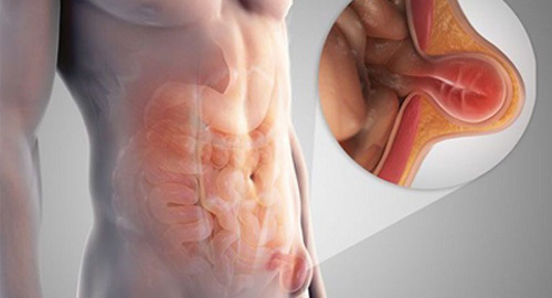 Việt kiều Mỹ chọn về Việt Nam làm phẫu thuật