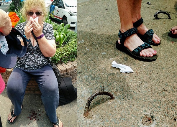 Du khách ngã vỡ mặt vì móc sắt thành 'bẫy' người trên phố Sài Gòn