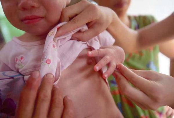 Mẹ hoảng hốt khi con gái 18 tháng tuổi có kinh nguyệt