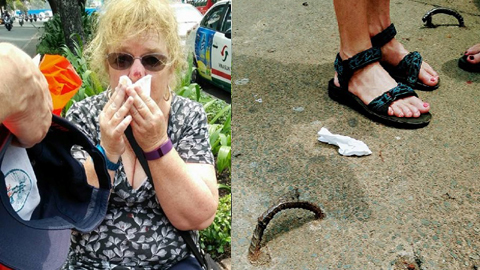 Bồi thường 1.000 USD vụ du khách ngã vỡ mặt vì 'bẫy' trên phố