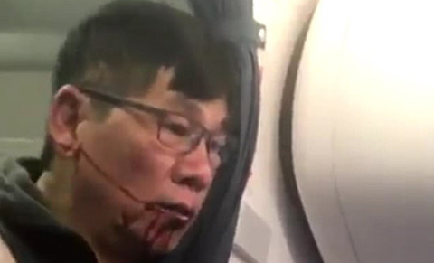 bác sĩ bị lôi khỏi máy bay