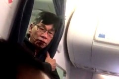 'Overbook' không hành xử như United Airlines kéo lê BS David Dao