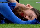 Bị đánh chảy máu miệng, Messi điên tiết hạ đẹp Real
