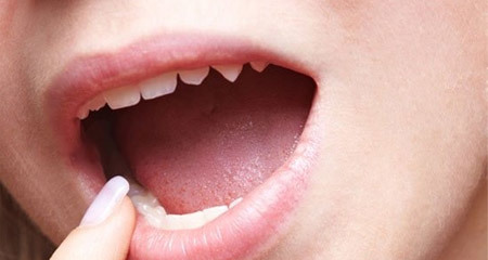 10 dấu hiệu cảnh báo sớm ung thư đang lớn dần trong cơ thể: Ai cũng nên thuộc nằm lòng