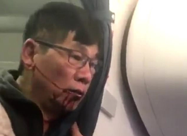 United Airlines bồi thường cho bác sĩ Dao