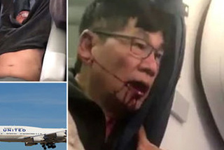 United Airlines phải trả bao nhiêu cho sự im lặng từ bác sĩ Dao?
