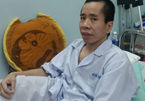 Phẫu thuật cho người em cặp song sinh dính liền Việt - Đức