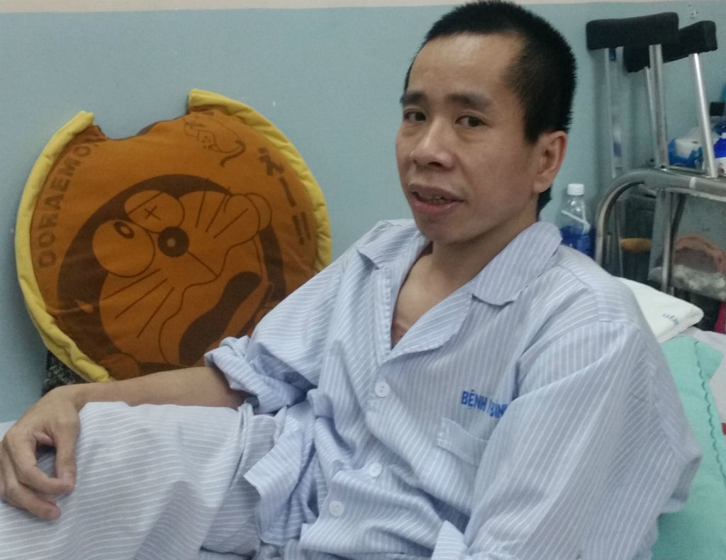 Phẫu thuật cho người em cặp song sinh dính liền Việt - Đức