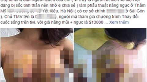 Ngực có dấu hiệu hoại tử sau khi phẫu thuật thẩm mỹ