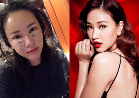 Maya gây xôn xao với khuôn mặt vừa phẫu thuật thẩm mỹ