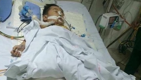 Cha mẹ nghèo bất lực chứng kiến con bị cưa chân sau tai nạn