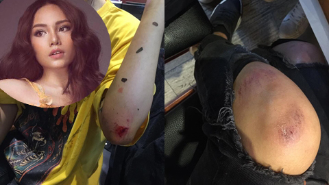 Quán quân Giọng hát Việt bị tai nạn