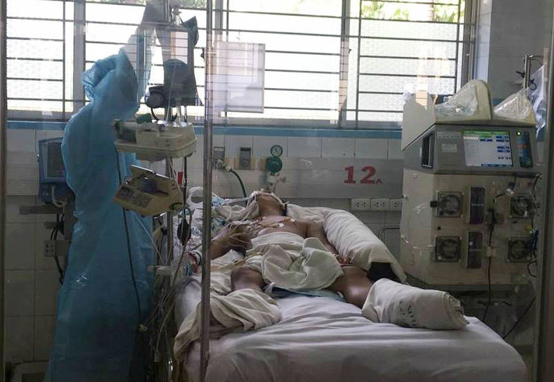 Người đàn ông liên tục phải lọc máu từ vết cào xước của chó nhà