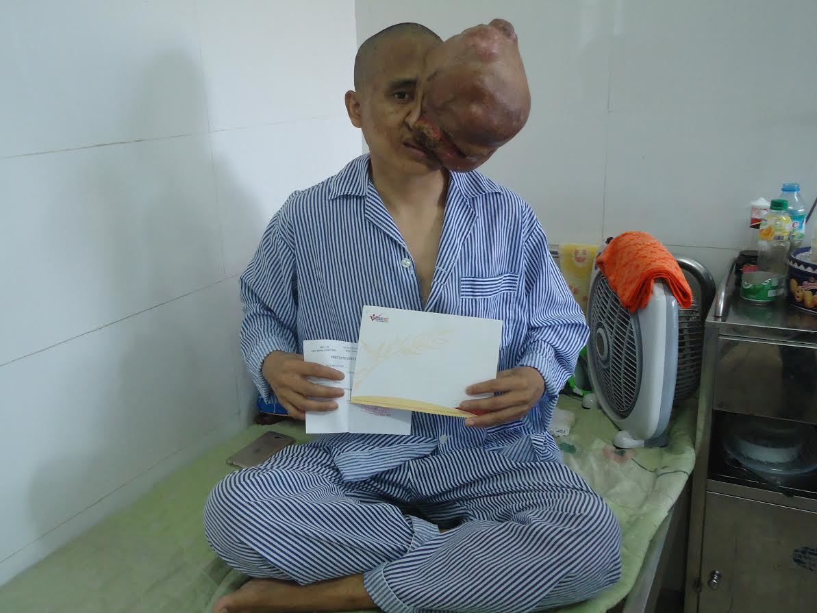 Người đàn ông mang 