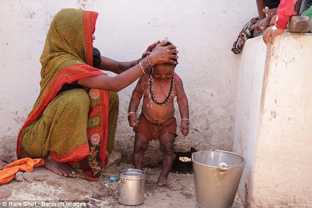 Gặp người đàn ông 50 tuổi cao 74cm