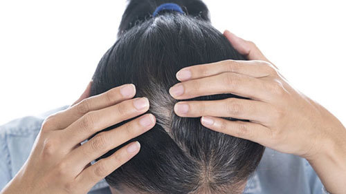 Phòng ngừa tóc bạc sớm như thế nào?