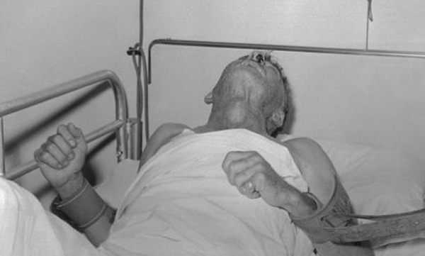 Thiệt hại mỗi năm hơn 800 tỷ phòng bệnh dại