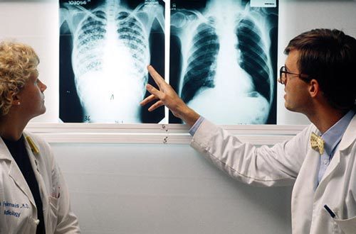 4 nguyên tắc để chữa khỏi bệnh lao