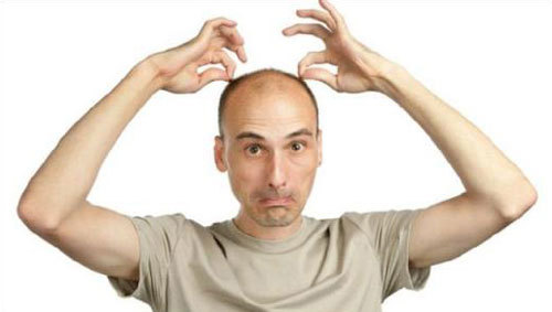 Rụng tóc ở nam giới: những vấn đề đáng chú ý