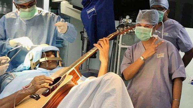 Nghệ sĩ chơi đàn trong lúc mổ não