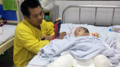 BV Việt Đức: Bé cụt chân do đá đè diễn biến bệnh phức tạp